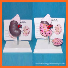 Medical Science Human Healthy Kidney Model